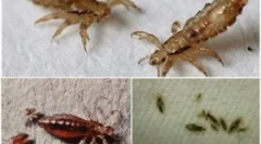 Omotavanje i kako ga ukloniti